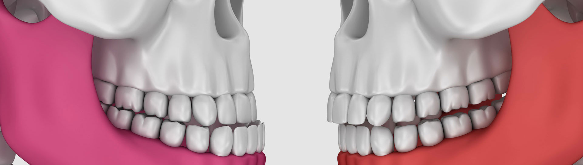 https://drfotinos.com/wp-content/uploads/2020/03/11-2019_Neuromuscular_Dentistry_TMJ_Treatments_banner-1.jpg