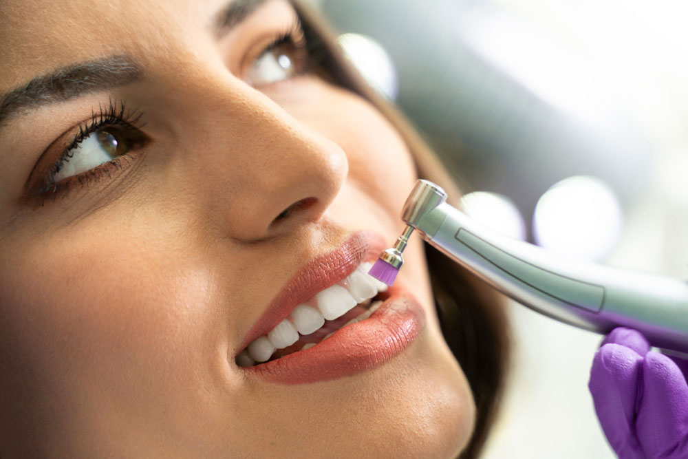 Dental Polishing​ at Orange California