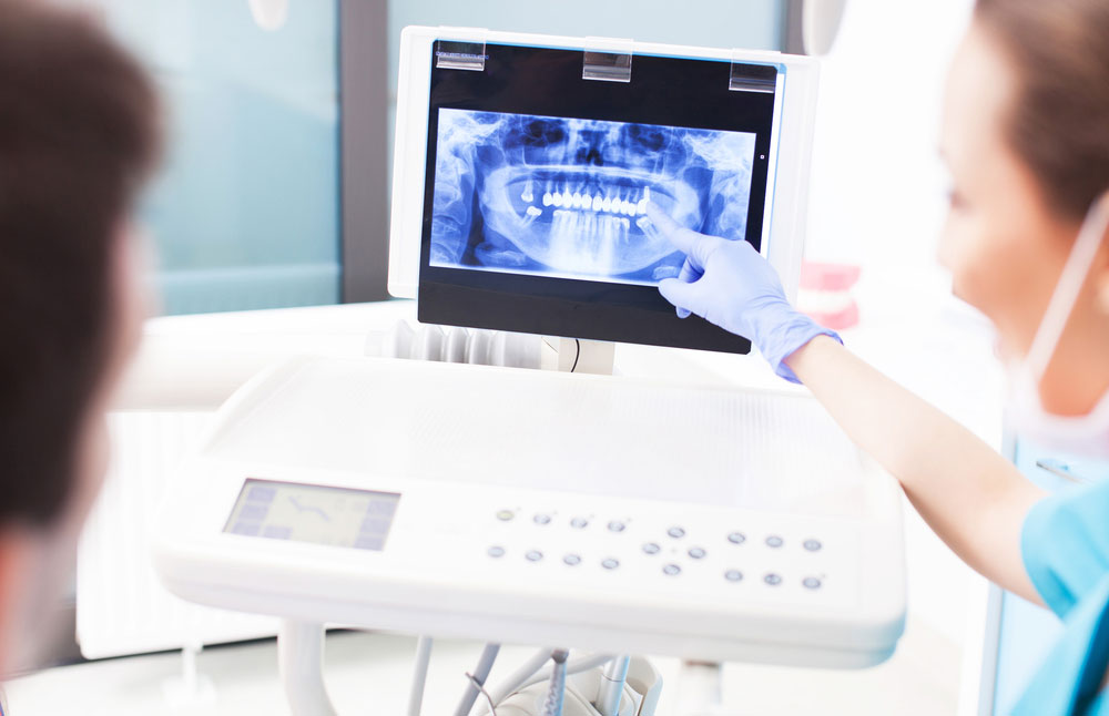 Dental X-Rays​ at Orange California