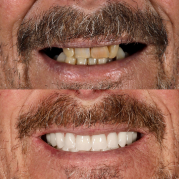 Dr._Fotinos_Before_&_After_3-31-21