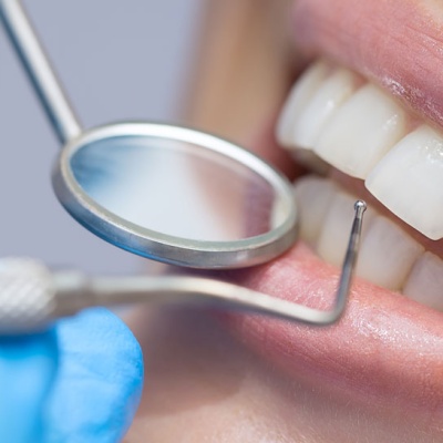 why-you-should-visit-the-dentist-regularly-banner