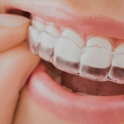 5-of-the-most-popular-cosmetic-dentistry-treatments-banner